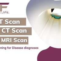 Pet scan VS CT VS MRI
