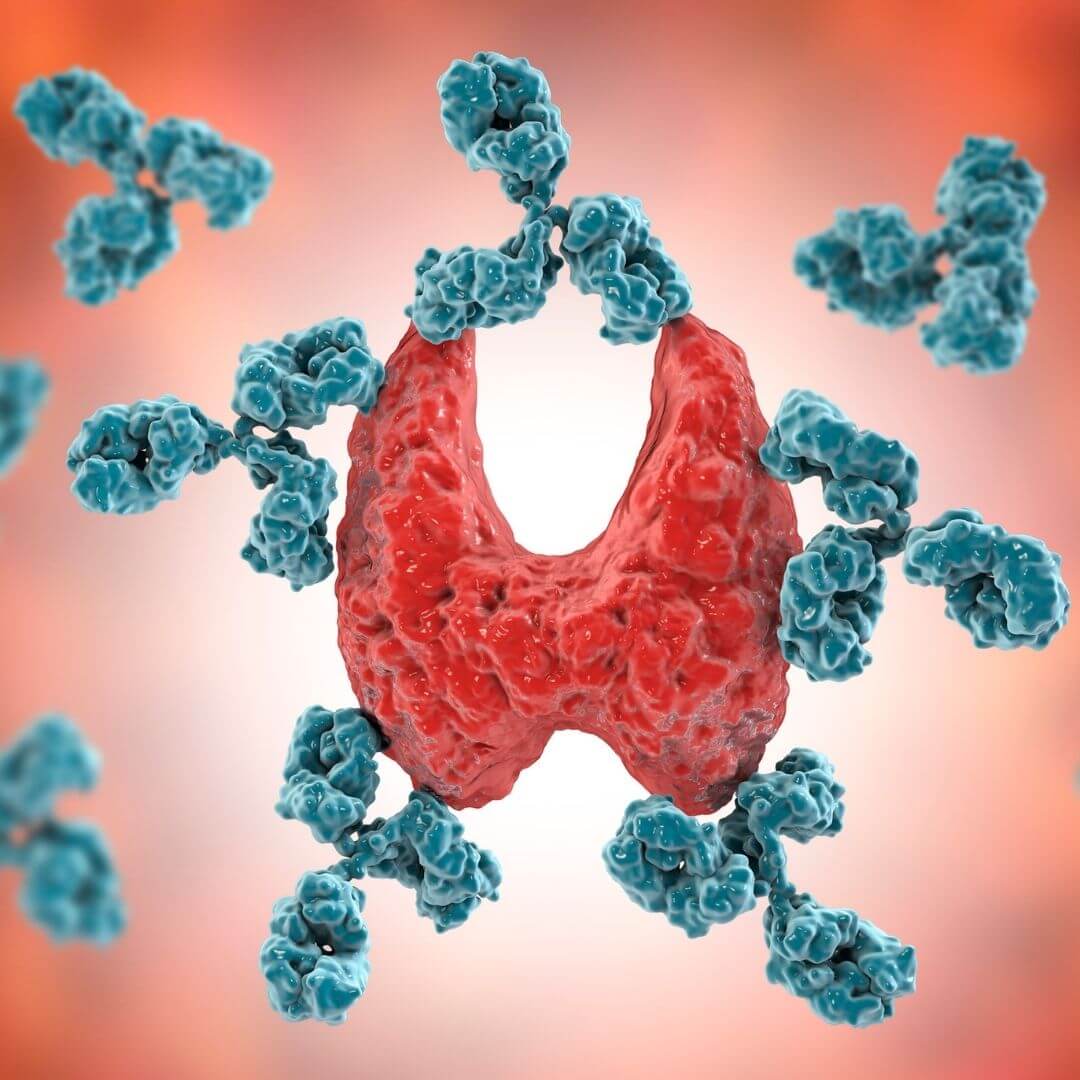 Thyroid-Scan