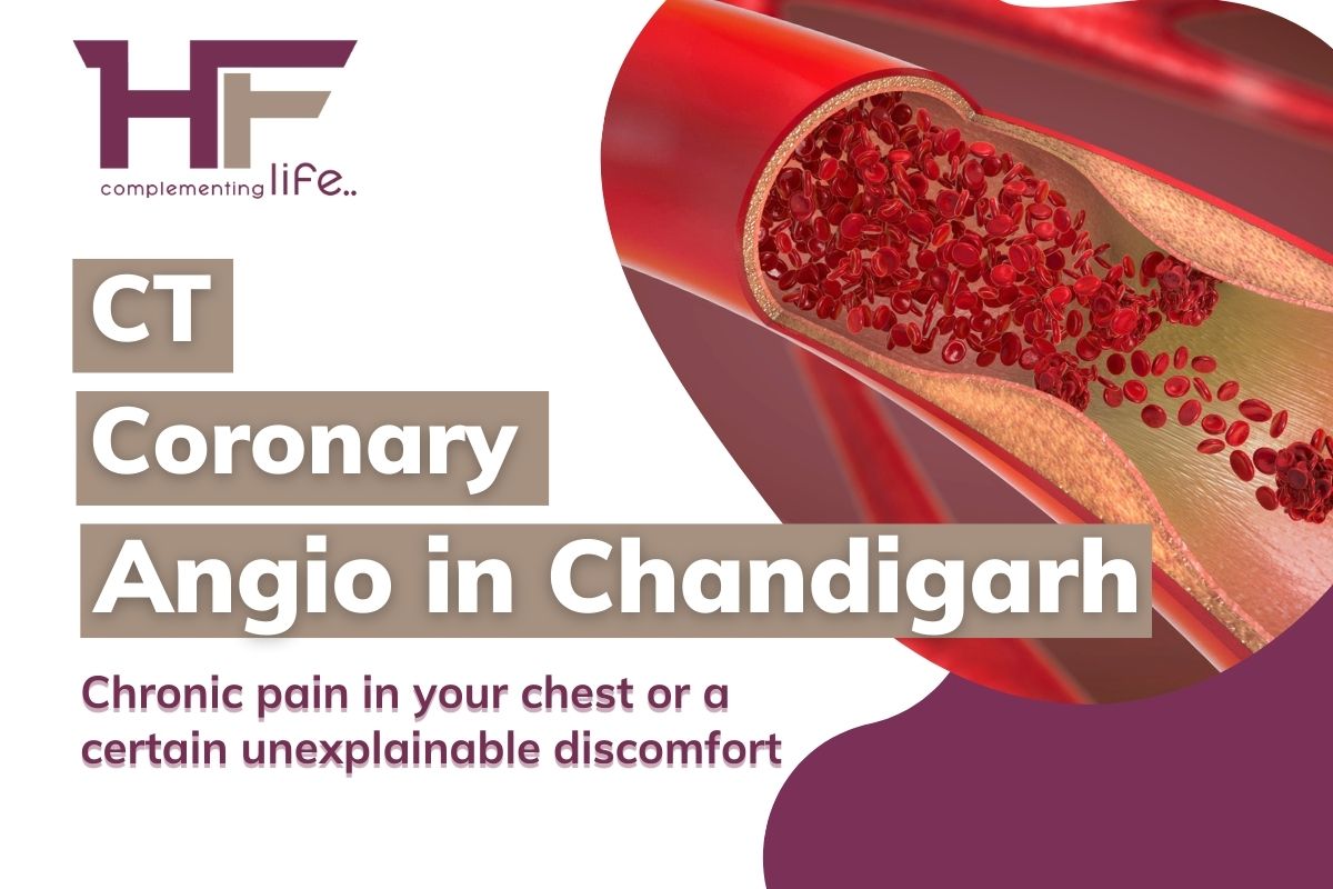 CT Angiography in Chandigarh