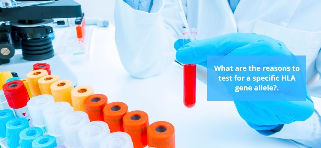 What are the reasons to test for a specific HLA gene allele.