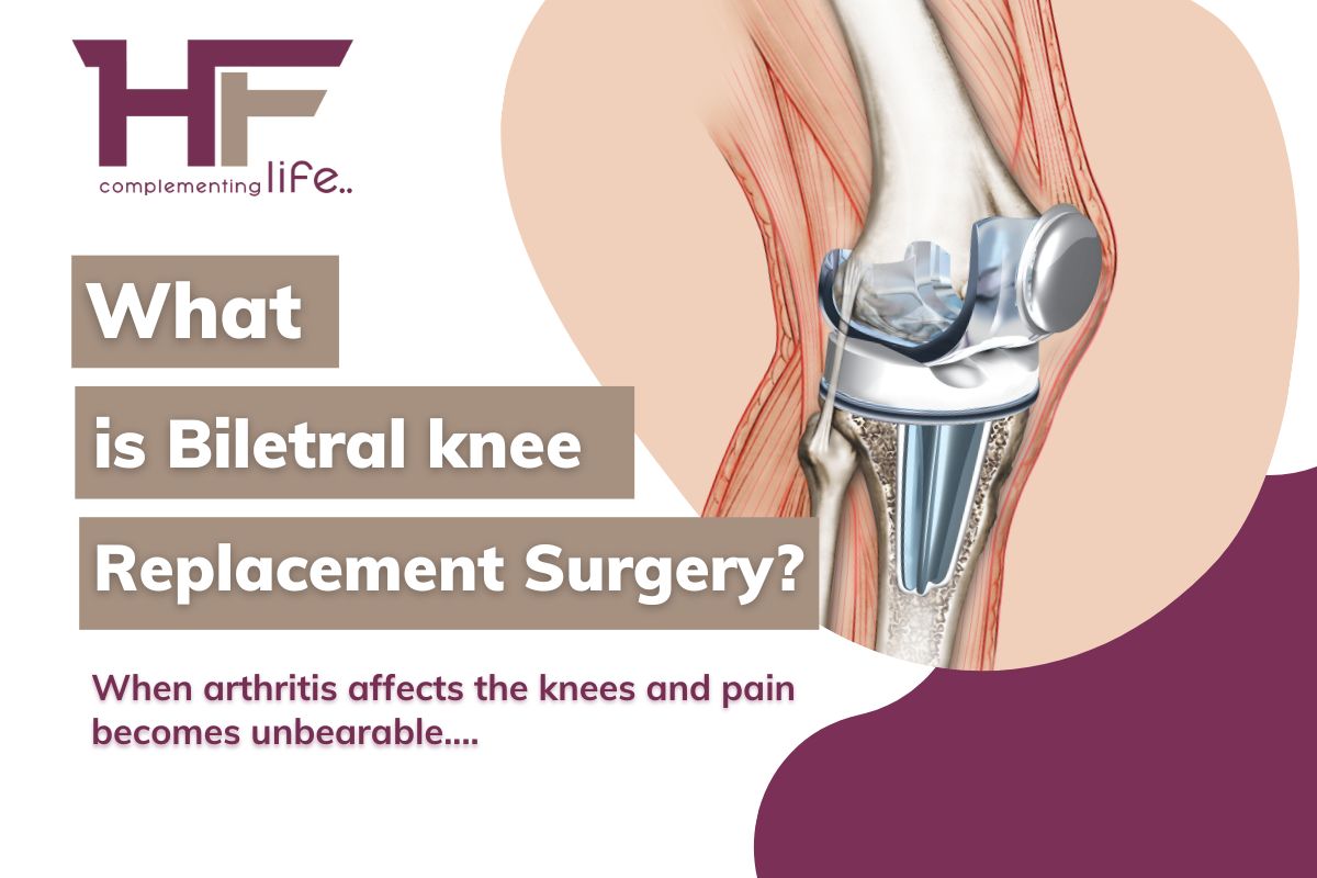 What is bilateral knee replacement surgery?