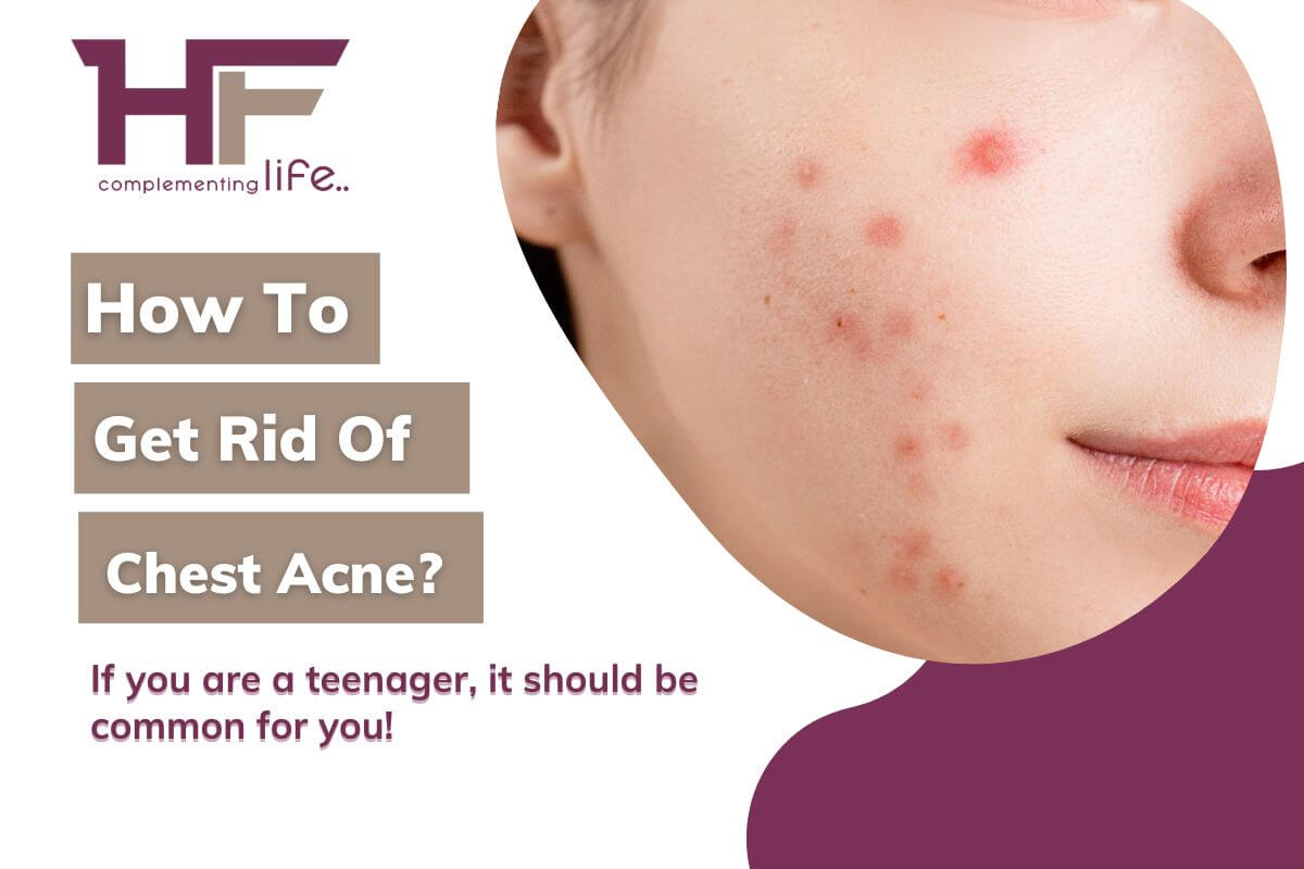 How To Get Rid Of Chest Acne?