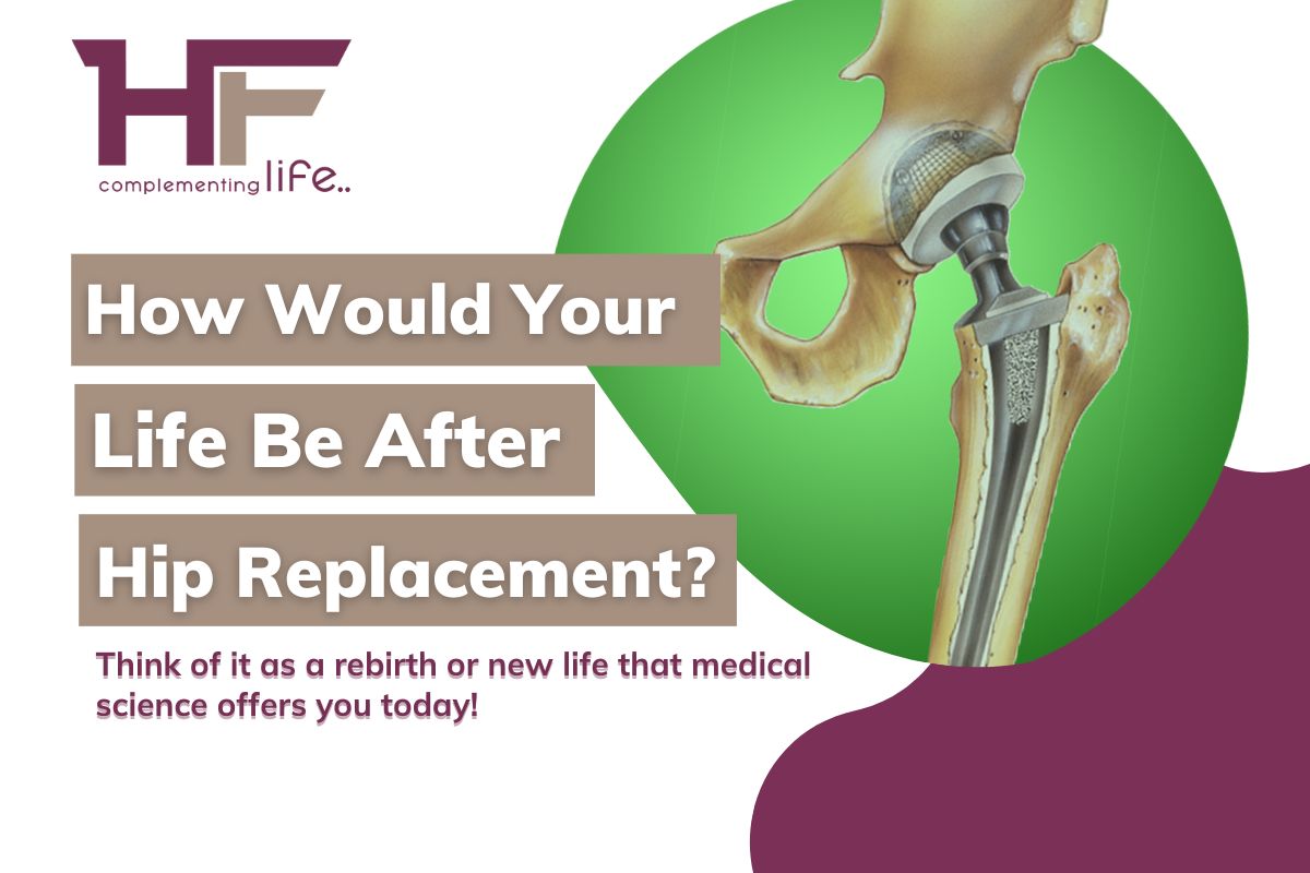 How Would Your Life Be After Hip Replacement?