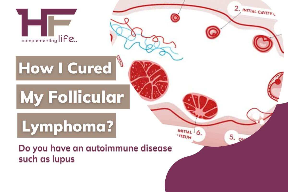 How I Cured My Follicular Lymphoma?