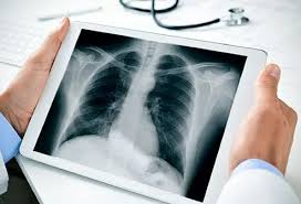 X-ray in Lucknow